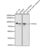 Western Blot - Anti-Villin Antibody (A14804) - Antibodies.com