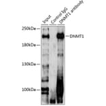 Western Blot - Anti-Dnmt1 Antibody (A14805) - Antibodies.com