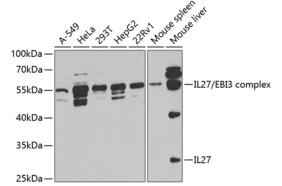 Western Blot - Anti-IL-27-A Antibody (A14806) - Antibodies.com