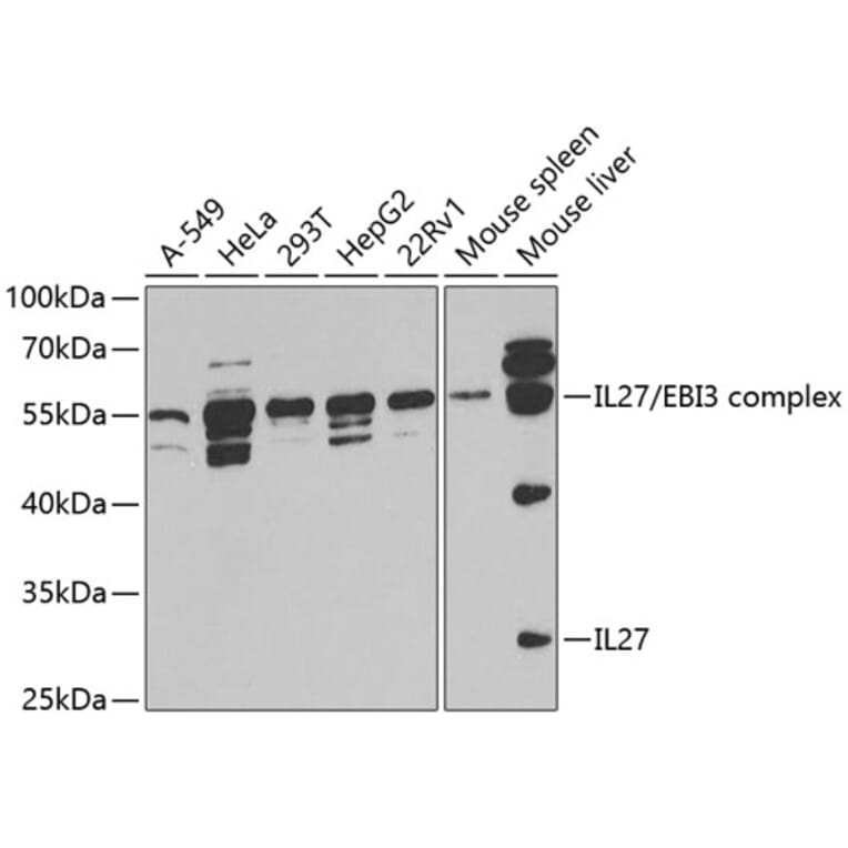 Western Blot - Anti-IL-27-A Antibody (A14806) - Antibodies.com