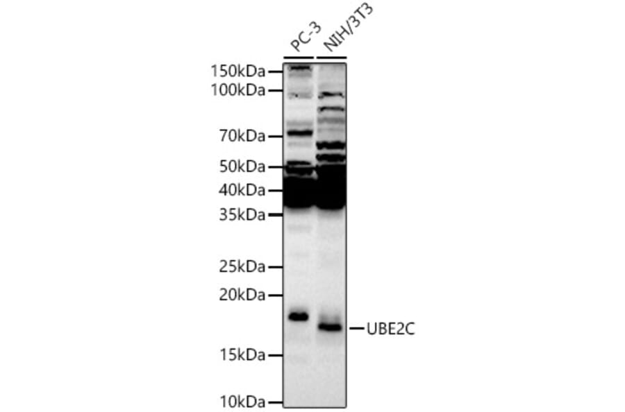 Western Blot - Anti-UBE2C Antibody (A14807) - Antibodies.com