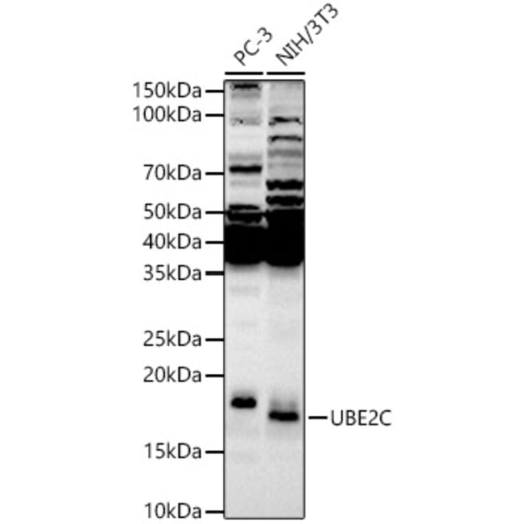 Western Blot - Anti-UBE2C Antibody (A14807) - Antibodies.com