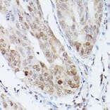 Immunohistochemistry - Anti-UBE2C Antibody (A14807) - Antibodies.com