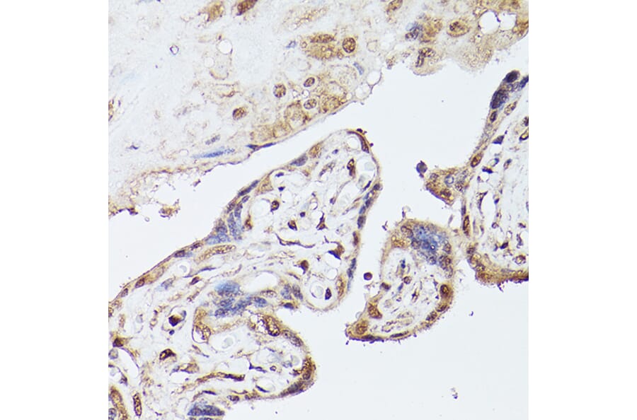 Immunohistochemistry - Anti-UBE2C Antibody (A14807) - Antibodies.com