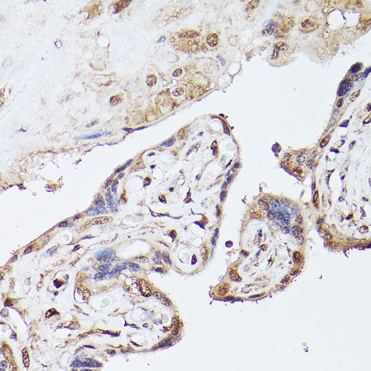 Immunohistochemistry - Anti-UBE2C Antibody (A14807) - Antibodies.com