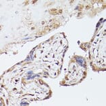 Immunohistochemistry - Anti-UBE2C Antibody (A14807) - Antibodies.com