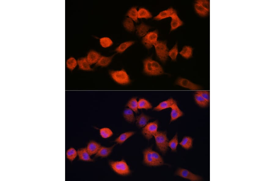 Immunofluorescence - Anti-UBE2C Antibody (A14807) - Antibodies.com