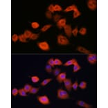 Immunofluorescence - Anti-UBE2C Antibody (A14807) - Antibodies.com