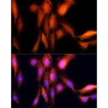 Immunofluorescence - Anti-UBE2C Antibody (A14807) - Antibodies.com