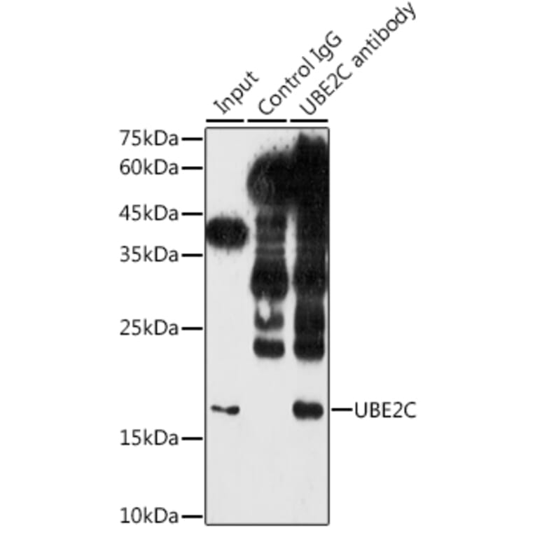 Western Blot - Anti-UBE2C Antibody (A14807) - Antibodies.com