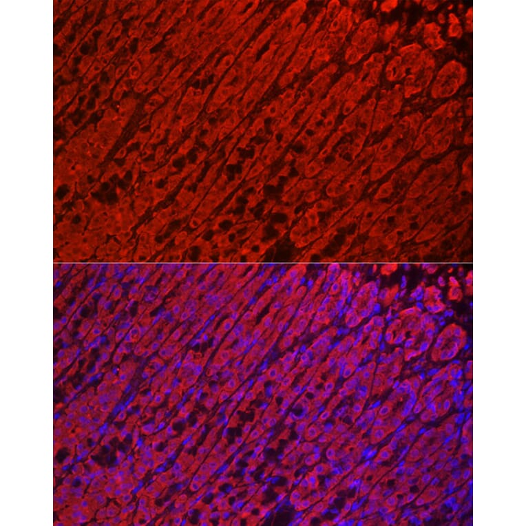 Immunofluorescence - Anti-ALDH3A1 Antibody (A14810) - Antibodies.com