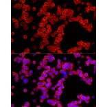 Immunofluorescence - Anti-ALDH3A1 Antibody (A14810) - Antibodies.com