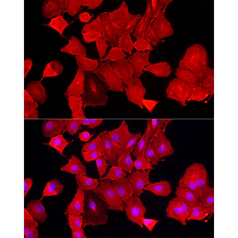 Immunofluorescence - Anti-ALDH3A1 Antibody (A14810) - Antibodies.com