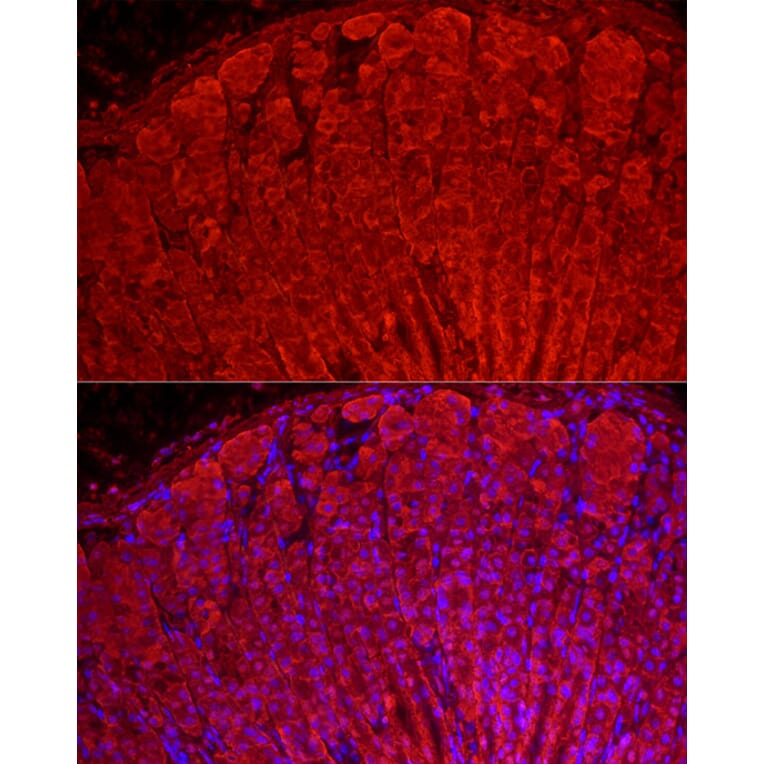 Immunofluorescence - Anti-ALDH3A1 Antibody (A14810) - Antibodies.com