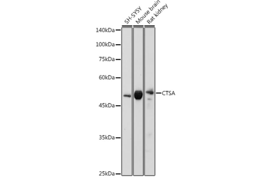 Western Blot - Anti-Protective protein/Cathepsin A (phospho PCA) Antibody (A14811) - Antibodies.com
