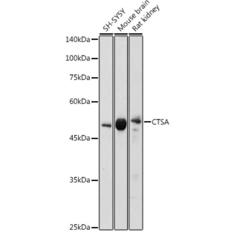Western Blot - Anti-Protective protein/Cathepsin A (phospho PCA) Antibody (A14811) - Antibodies.com