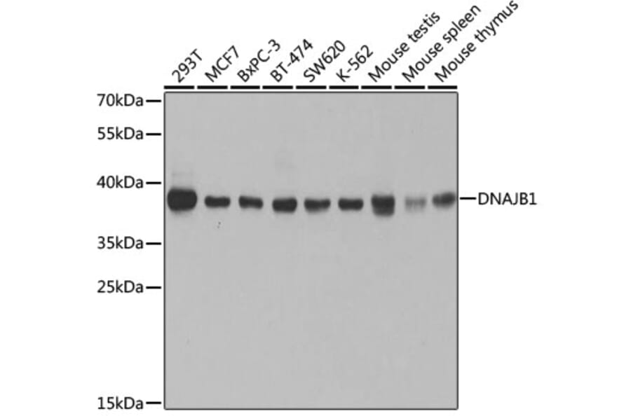 Western Blot - Anti-Hsp40 Antibody (A14812) - Antibodies.com