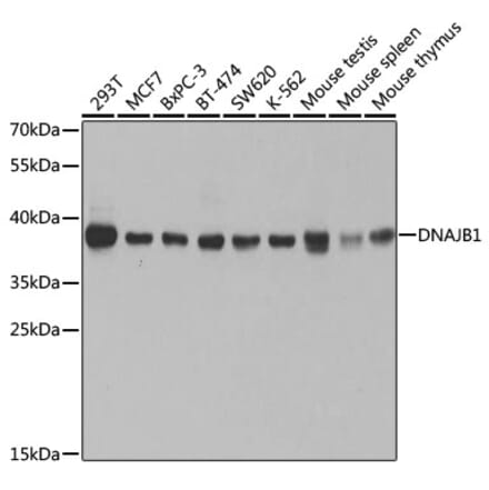 Western Blot - Anti-Hsp40 Antibody (A14812) - Antibodies.com