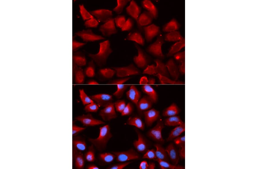 Immunofluorescence - Anti-Hsp40 Antibody (A14812) - Antibodies.com