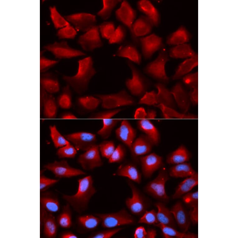 Immunofluorescence - Anti-Hsp40 Antibody (A14812) - Antibodies.com