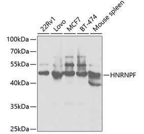 Western Blot - Anti-hnRNPF Antibody (A14813) - Antibodies.com