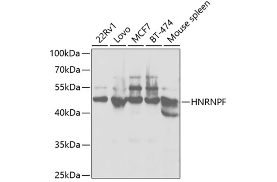 Western Blot - Anti-hnRNPF Antibody (A14813) - Antibodies.com