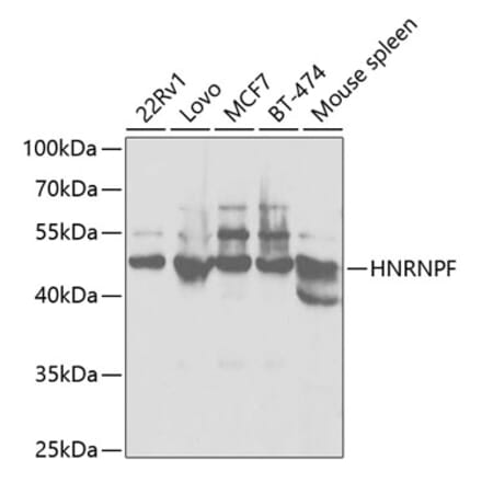 Western Blot - Anti-hnRNPF Antibody (A14813) - Antibodies.com