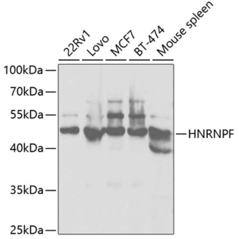 Western Blot - Anti-hnRNPF Antibody (A14813) - Antibodies.com