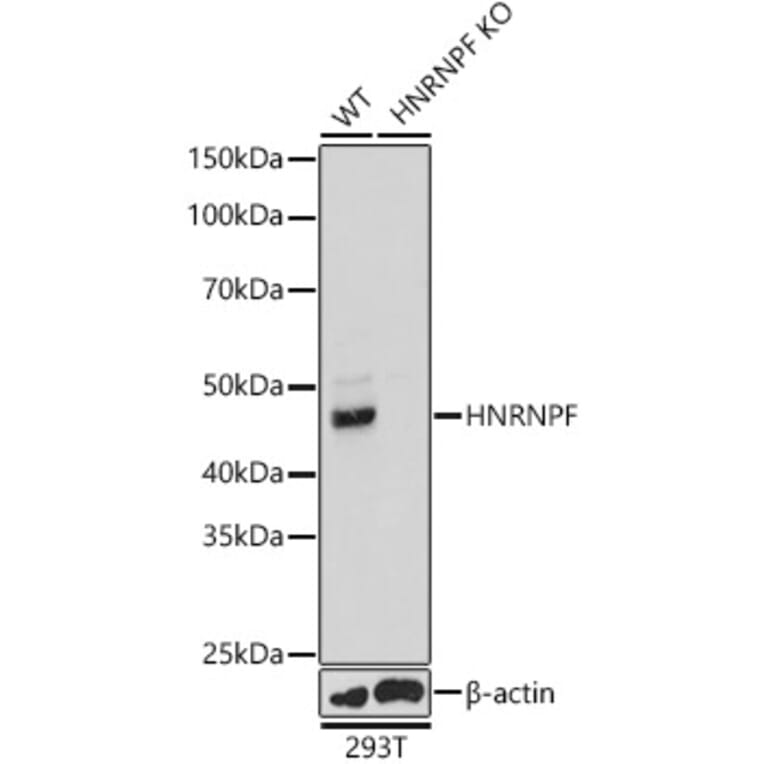 Western Blot - Anti-hnRNPF Antibody (A14813) - Antibodies.com