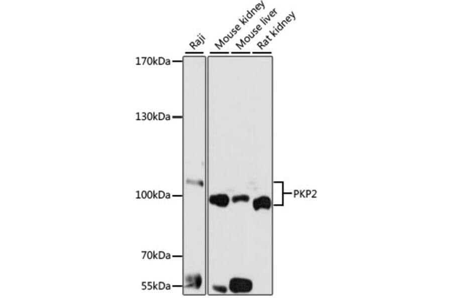 Western Blot - Anti-Plakophilin 2/PKP2 Antibody (A14814) - Antibodies.com