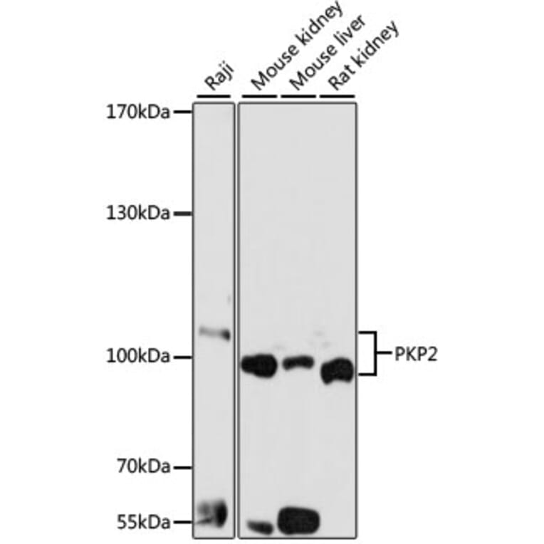 Western Blot - Anti-Plakophilin 2/PKP2 Antibody (A14814) - Antibodies.com