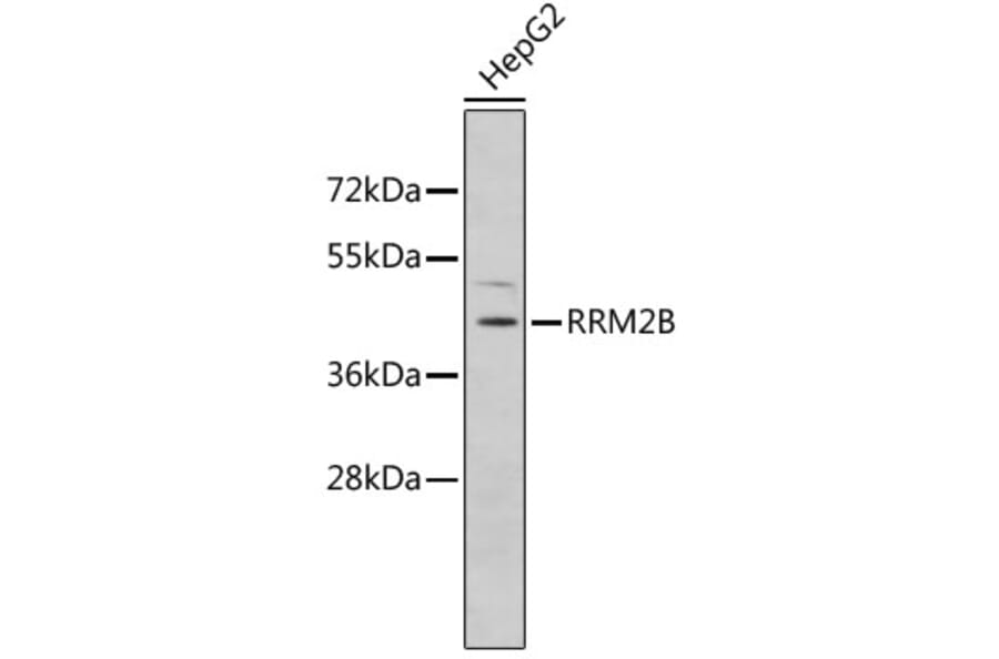 Western Blot - Anti-RRM2B Antibody (A5516) - Antibodies.com