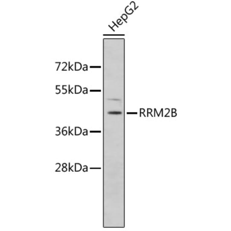Western Blot - Anti-RRM2B Antibody (A5516) - Antibodies.com