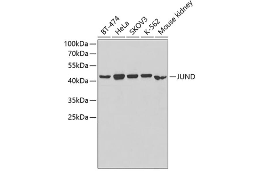 Western Blot - Anti-JUND Antibody (A5517) - Antibodies.com