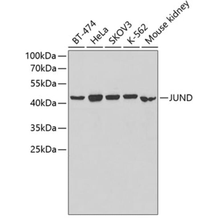 Western Blot - Anti-JUND Antibody (A5517) - Antibodies.com
