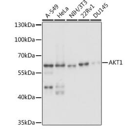 Western Blot - Anti-AKT1 Antibody (A14818) - Antibodies.com
