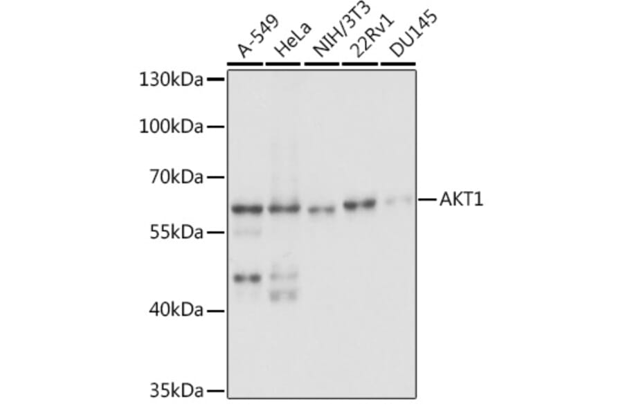 Western Blot - Anti-AKT1 Antibody (A14818) - Antibodies.com