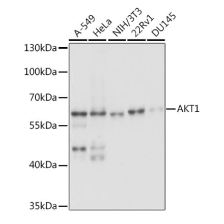 Western Blot - Anti-AKT1 Antibody (A14818) - Antibodies.com
