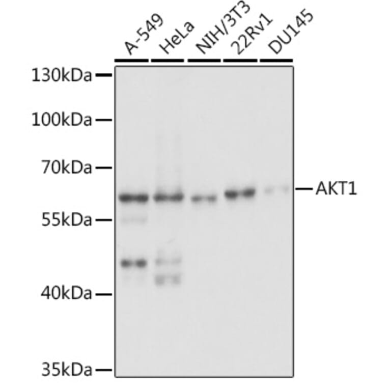 Western Blot - Anti-AKT1 Antibody (A14818) - Antibodies.com