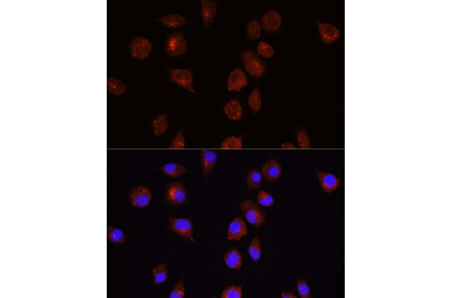 Immunofluorescence - Anti-AKT1 Antibody (A14818) - Antibodies.com