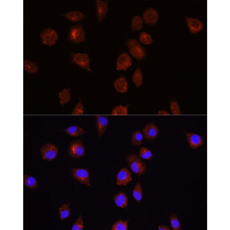 Immunofluorescence - Anti-AKT1 Antibody (A14818) - Antibodies.com