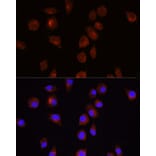 Immunofluorescence - Anti-AKT1 Antibody (A14818) - Antibodies.com
