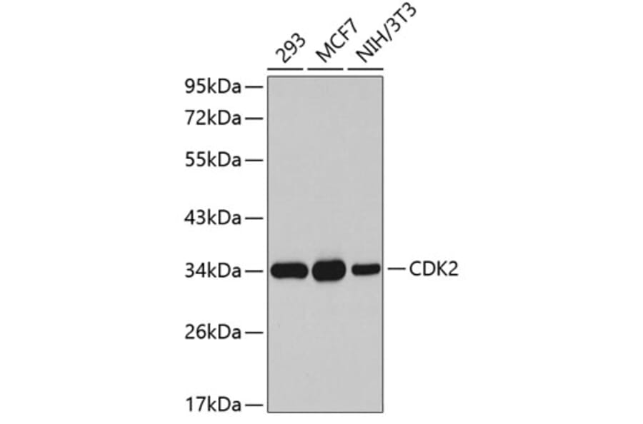 Western Blot - Anti-CDK2 Antibody (A5525) - Antibodies.com