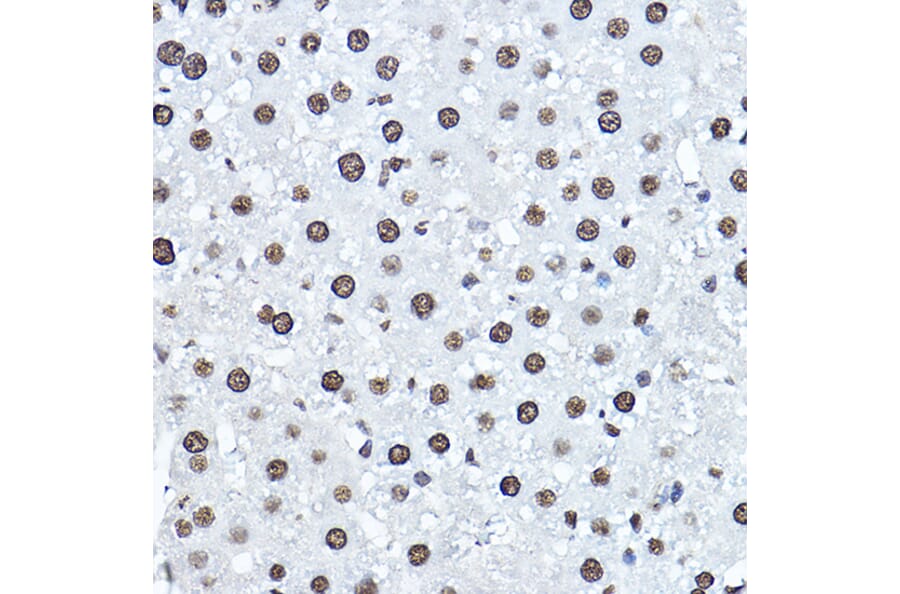 Immunohistochemistry - Anti-Twist Antibody (A14821) - Antibodies.com