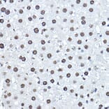 Immunohistochemistry - Anti-Twist Antibody (A14821) - Antibodies.com