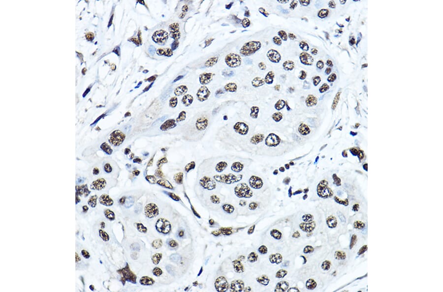 Immunohistochemistry - Anti-Twist Antibody (A14821) - Antibodies.com