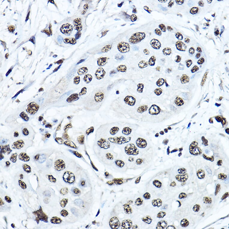 Immunohistochemistry - Anti-Twist Antibody (A14821) - Antibodies.com