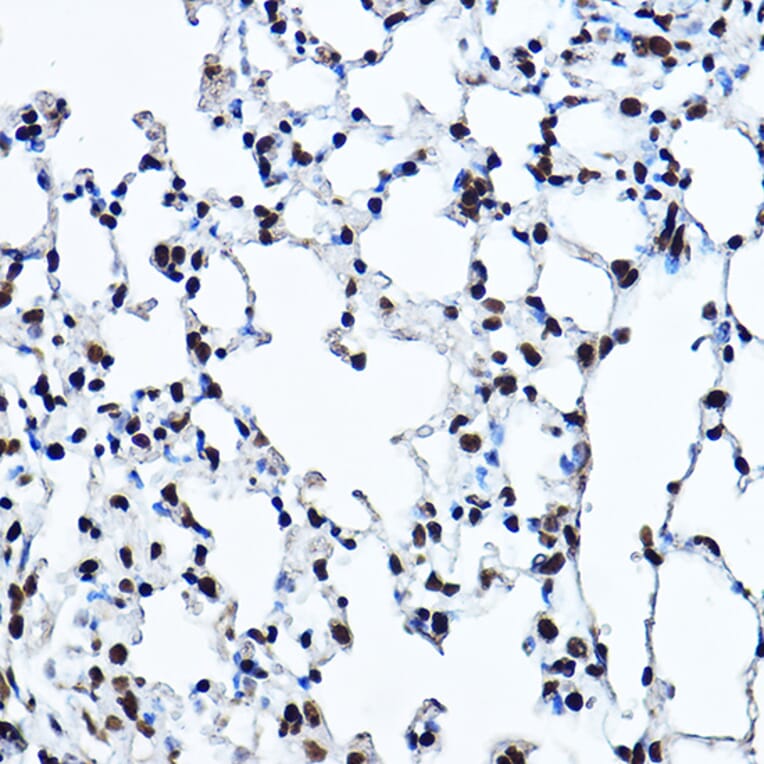 Immunohistochemistry - Anti-Twist Antibody (A14821) - Antibodies.com