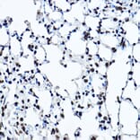 Immunohistochemistry - Anti-Twist Antibody (A14821) - Antibodies.com