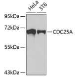 Western Blot - Anti-CDC25A Antibody (A5527) - Antibodies.com